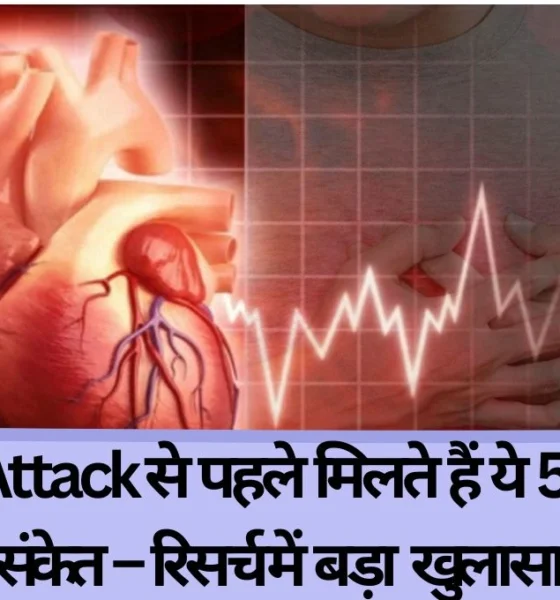 Heart attack