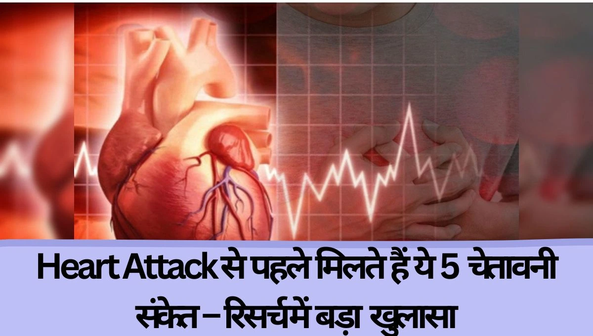 Heart attack